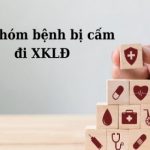 nhom-benh-khong-duoc-di-xkld-nhat-ban